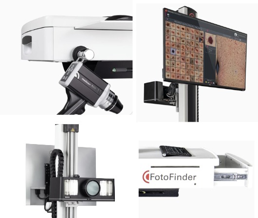 FotoFinder ATBM
